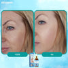 EternaSkin™ Anti-Aging Serum – Jünger aussehen ohne Nadeln