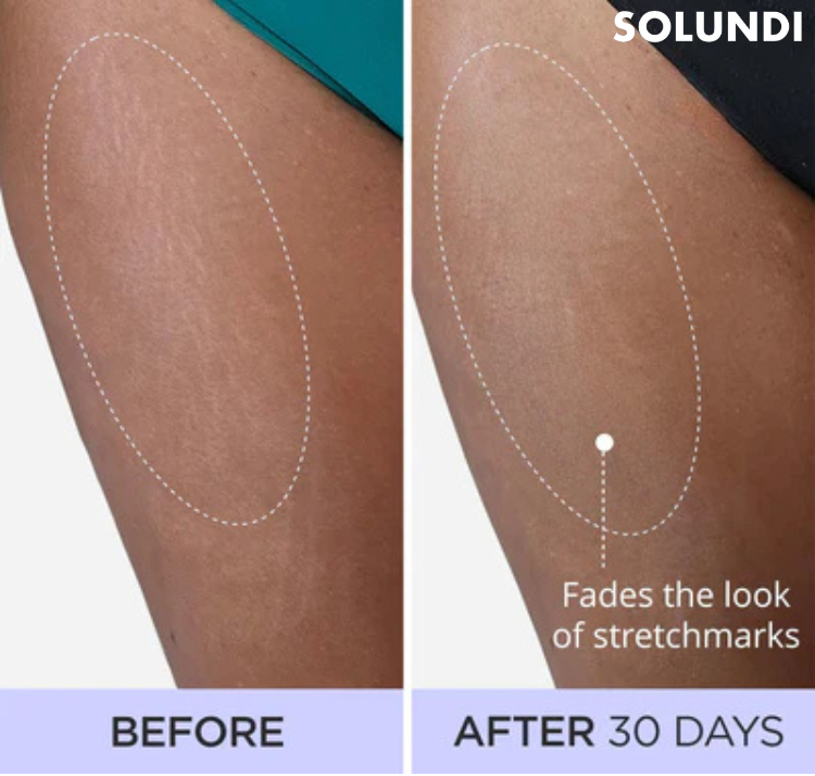 SculpturaSkin™ Straffende Creme | Glattere Haut ohne Mühe