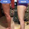CurveErase™ – Die ultimative Lösung für glatte, cellulitisfreie Haut.