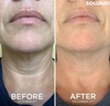 SculpturaSkin™ Straffende Creme | Glattere Haut ohne Mühe