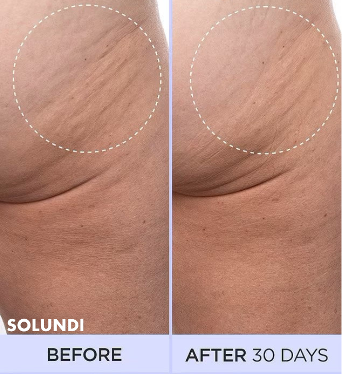 SculpturaSkin™ Straffende Creme | Glattere Haut ohne Mühe