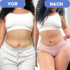 CurveErase™ – Die ultimative Lösung für glatte, cellulitisfreie Haut.