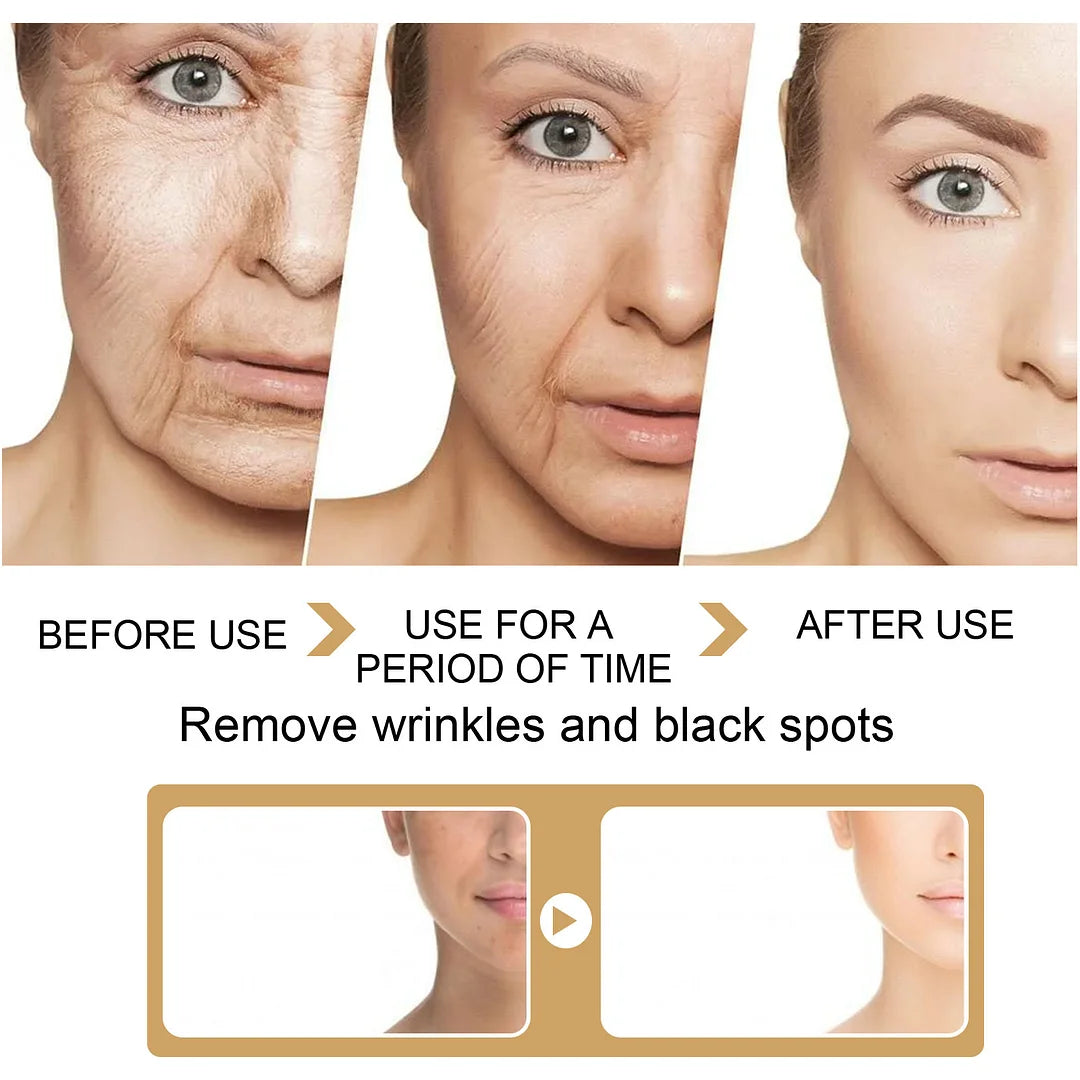 Vitalize™ Kurkuma Serum zur Korrektur dunkler Flecken | 60% RABATT