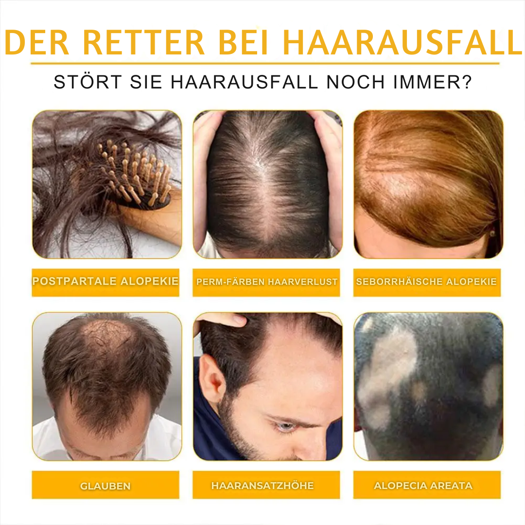 HairGrowth™ - Das schnelle Haarwachstumsspray für Männer und Frauen