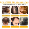 HairGrowth™ - Das schnelle Haarwachstumsspray für Männer und Frauen