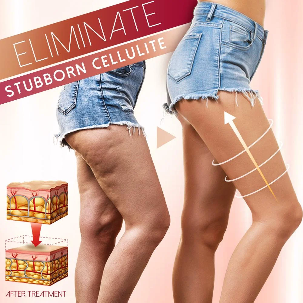 SculptSlim™ Formt, strafft und festigt Ihren Körper mit unserem Massageshaper!