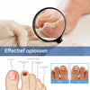 FungoFree™ Anti-Nagelpilz Pflaster | Für dauerhaft gesunde, schöne Nägel