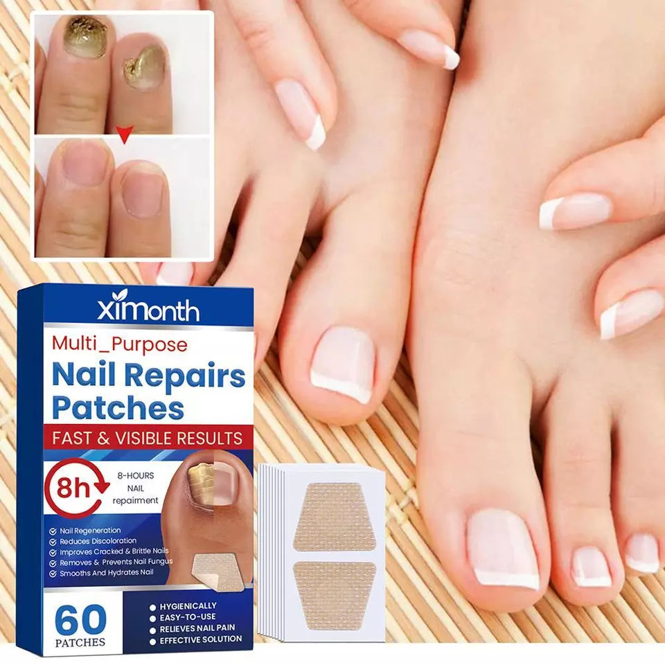 FungoFree™ Anti-Nagelpilz Pflaster | Für dauerhaft gesunde, schöne Nägel