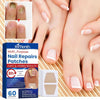FungoFree™ Anti-Nagelpilz Pflaster | Für dauerhaft gesunde, schöne Nägel